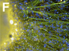 Neurônios sensórios da dor cultivados em 3D em laboratório.